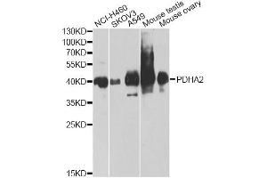 Western blot analysis of extracts of various cell lines, using PDHA2 antibody.