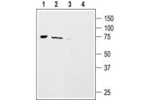 Western blot analysis of mouse ND7/23  neuroblastoma x rat DRG neuron hybrid cell line (lanes 1 and 3) and rat brain (lanes 2 and 4) lysates: - 1,2. (ACCN4 抗体  (Intracellular, N-Term))