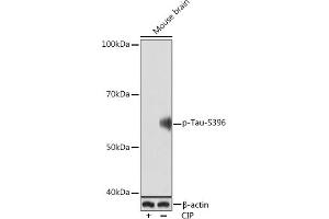 Western blot analysis of extracts of Mouse brain, using Phospho-Tau-S396 Rabbit mAb (ABIN7268523) at 1:1000 dilution. (MAPT 抗体  (pSer396))