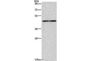 Western blot analysis of Mouse heart tissue, using IL5RA Polyclonal Antibody at dilution of 1:550 (IL5RA 抗体)