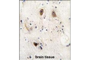 Formalin-fixed and paraffin-embedded human brain tissue reacted with ROR2 antibody, which was peroxidase-conjugated to the secondary antibody, followed by DAB staining. (ROR2 抗体)