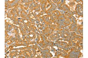 Immunohistochemistry (IHC) image for anti-Tyrosine-Protein Phosphatase Non-Receptor Type 22 (PTPN22) antibody (ABIN7130772)