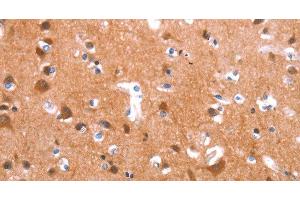 Immunohistochemistry of paraffin-embedded Human brain tissue using GAS8 Polyclonal Antibody at dilution 1:40 (GAS8 抗体)