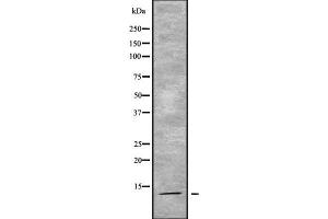 Western Blotting (WB) image for anti-Acylphosphatase 2, Muscle Type (Acyp2) (Internal Region) antibody (ABIN6259762)