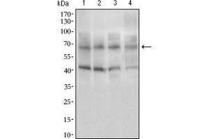 Western blot analysis using ABCG5 mouse mAb against HepG2 (1), HeLa (2), Jurkat (3), and Lovo (4) cell lysate. (ABCG5 抗体  (AA 306-367))