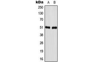 Western blot analysis of GABRA1 expression in U87MG (A), NIH3T3 (B) whole cell lysates. (GABRA1 抗体  (Center))