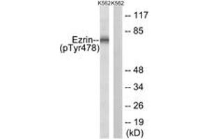 Image no. 1 for anti-Ezrin (EZR) (AA 446-495), (pTyr478) antibody (ABIN1532010) (Ezrin 抗体  (pTyr478))