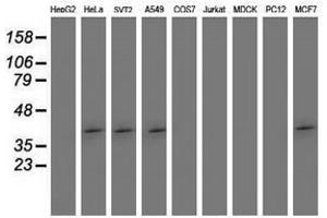 Image no. 2 for anti-SET Domain Containing (Lysine Methyltransferase) 7 (SETD7) antibody (ABIN1500903) (SETD7 抗体)