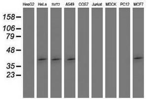 Image no. 2 for anti-SET Domain Containing (Lysine Methyltransferase) 7 (SETD7) antibody (ABIN1500903)