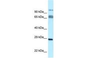 Image no. 1 for anti-Proline Rich Transmembrane Protein 1 (PRRT1) (N-Term) antibody (ABIN6747874) (PRRT1 抗体  (N-Term))