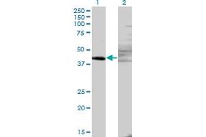 Western Blot analysis of ZNF193 expression in transfected 293T cell line by ZNF193 monoclonal antibody (M06), clone 3G6. (Zinc Finger and SCAN Domain Containing 9 (ZSCAN9) (AA 1-90) 抗体)