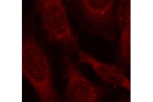 Immunofluorescence (IF) image for anti-Coactivator-Associated Arginine Methyltransferase 1 (CARM1) (pSer228) antibody (ABIN3020121) (CARM1 抗体  (pSer228))