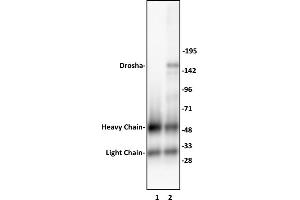 Drosha antibody (pAb) tested by Immunoprecipitation. (DROSHA 抗体  (C-Term))