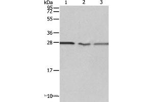 Western blot analysis of Jurkat, A549 cell and Human fetal kidney tissue, using PSMD9 Polyclonal Antibody at dilution of 1:750 (PSMD9 抗体)