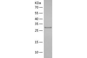 Western Blotting (WB) image for Sulfotransferase Family, Cytosolic, 2A, Dehydroepiandrosterone (DHEA)-Preferring, Member 1 (SULT2A1) (AA 1-285) protein (His tag) (ABIN7286978) (SULT2A1 Protein (AA 1-285) (His tag))