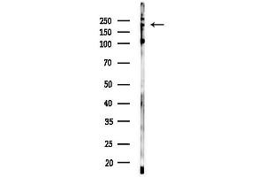 Western blot analysis of lysates from EC304 cells, using Phospho-NuMA (Thr2055) Antibody at 1/1000 dilution.