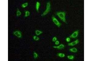 Detection of CS in Hela cells using Polyclonal Antibody to Citrate Synthase (CS) (CS 抗体  (AA 56-312))
