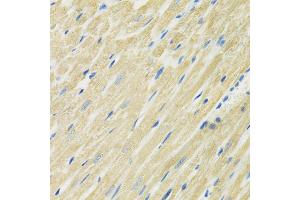 Immunohistochemistry of paraffin-embedded rat heart using SLC19A1 antibody (ABIN6291462) at dilution of 1:100 (40x lens). (SLC19A1 抗体)