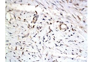 Immunohistochemistry (IHC) image for anti-Protein Phosphatase 1, Regulatory Subunit 13 Like (PPP1R13L) (AA 15-100) antibody (ABIN727280)