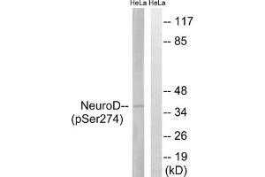 Western blot analysis of extracts from HeLa cells treated with UV using Neuro D (Phospho-Ser274) Antibody. (NEUROD1 抗体  (pSer274))
