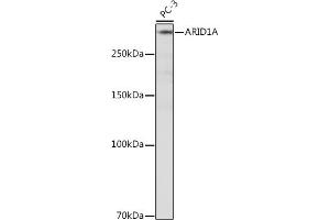 Western blot analysis of extracts of PC-3 cells, using A Rabbit mAb (ABIN7265699) at 1:500 dilution.