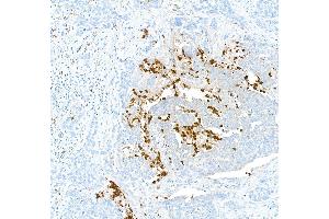 Immunohistochemistry (IHC) image for anti-S100 Calcium Binding Protein A9 (S100A9) (AA 64-114) antibody (ABIN7449432) (Recombinant S100A9 抗体  (AA 64-114))