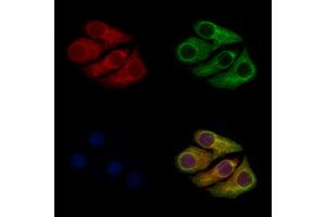 ABIN7094660 and ABIN7098711 staining Hela cells by IF/ICC.
