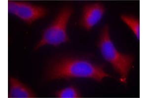 Image no. 3 for anti-Microtubule-Associated Protein tau (MAPT) (pSer262) antibody (ABIN196808) (MAPT 抗体  (pSer262))
