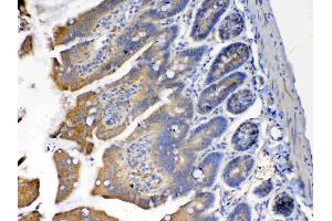 IHC analysis of PON1 using anti-PON1 antibody . (PON1 抗体  (AA 30-274))