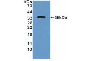 Detection of Recombinant MAP1B, Human using Polyclonal Antibody to Microtubule Associated Protein 1B (MAP1B) (MAP1B 抗体  (AA 2207-2468))