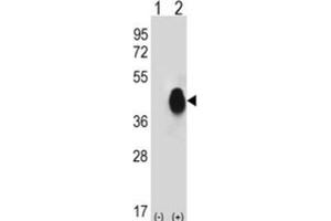 Western Blotting (WB) image for anti-CD38 antibody (ABIN3001687) (CD38 抗体)