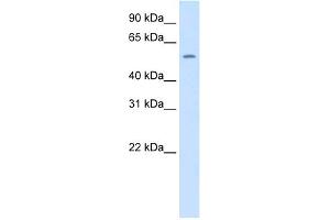WB Suggested Anti-Thrb Antibody Titration:  1. (THRB 抗体  (N-Term))