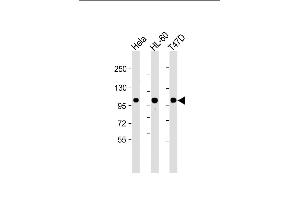 All lanes : Anti-EZH2 Antibody at 1:2000 dilution Lane 1: Hela whole cell lysate Lane 2: HL-60 whole cell lysate Lane 3: T47D whole cell lysate Lysates/proteins at 20 μg per lane.