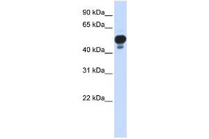WB Suggested Anti-RING1 Antibody Titration: 0. (RING1 抗体  (Middle Region))