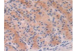 DAB staining on IHC-P; Samples: Rat Stomach Tissue (PFKP 抗体  (AA 354-570))