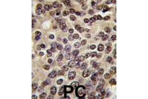 Immunohistochemistry (IHC) image for anti-PKN beta antibody (ABIN3003586) (PKN beta 抗体)