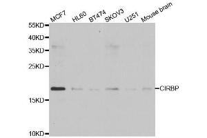 Western blot analysis of extracts of various cell lines, using CIRBP antibody. (CIRBP 抗体  (AA 1-172))