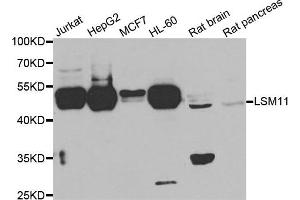 Western blot analysis of extracts of various cell lines, using LSM11 antibody. (LSM11 抗体)