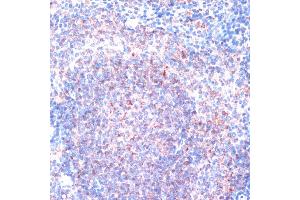 Immunohistochemistry of paraffin-embedded mouse spleen using RPS6K antibody (5718) at dilution of 1:100 (40x lens). (RPS6KA1 抗体  (C-Term))