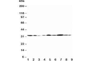 Western blot testing of Connexin 32 antibody and Lane 1:  rat heart;  2: rat heart;  3: rat skeletal muscle;  4: rat brain;  5: MCF-7;  6: HeLa;  7: SMMC-7721;  8: Jurkat;  9: COLO320 (GJB1 抗体  (Middle Region))