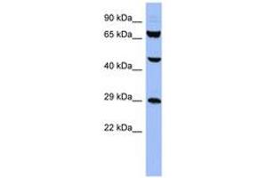 Image no. 1 for anti-Small Nuclear Ribonucleoprotein Polypeptides B and B1 (SNRPB) (AA 35-84) antibody (ABIN6742979)