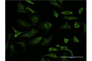 Immunofluorescence (IF) image for anti-Poly(rC) Binding Protein 2 (PCBP2) (AA 1-362) antibody (ABIN518658)