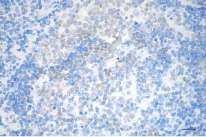 Immunohistochemistry was performed on paraffin-embedded human tonsillitis using DNA methyltransferase 1 antibody (ABIN7798362), 1:200). (Recombinant DNMT1 抗体)