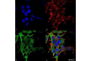 Immunocytochemistry/Immunofluorescence analysis using Mouse Anti-GABA-B Receptor 2 Monoclonal Antibody, Clone S81-2 . (GABBR2 抗体  (AA 861-912))