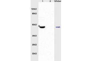 Lane 1: mouse brain lysates Lane 2: human colon carcinoma lysates probed with Anti MMP-23 Polyclonal Antibody, Unconjugated (ABIN759176) at 1:200 in 4 °C. (Matrix Metallopeptidase 23 (MMP23) (AA 281-380) 抗体)