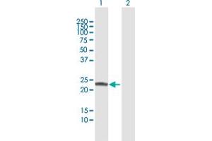 Western Blot analysis of COMT expression in transfected 293T cell line by COMT MaxPab polyclonal antibody. (COMT 抗体  (AA 1-221))