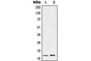 Western blot analysis of UBE2A/B expression in HeLa (A), Jurkat (B) whole cell lysates. (UBE2A/B (C-Term) 抗体)