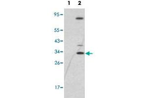 Western blot analysis of SNAI1 (arrow) using SNAI1 polyclonal antibody . (SNAIL 抗体  (N-Term))