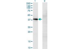 Western Blot analysis of NOV expression in transfected 293T cell line by NOV monoclonal antibody (M02), clone 2G8. (NOV 抗体  (AA 32-131))