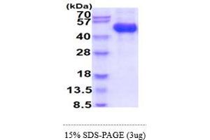 SDS-PAGE (SDS) image for Colony Stimulating Factor 2 Receptor, Alpha, Low-Affinity (Granulocyte-Macrophage) (CSF2RA) (AA 20-320) (Active) protein (His tag) (ABIN5855034)